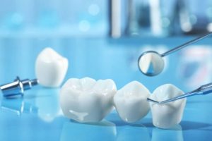 recovering-after-dental-bridge-placement-what-to-expect-300x200